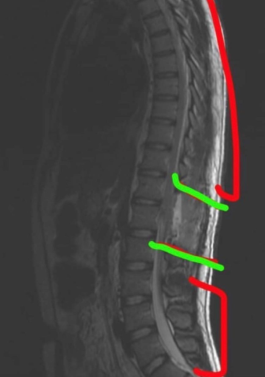 Storbeck MRI